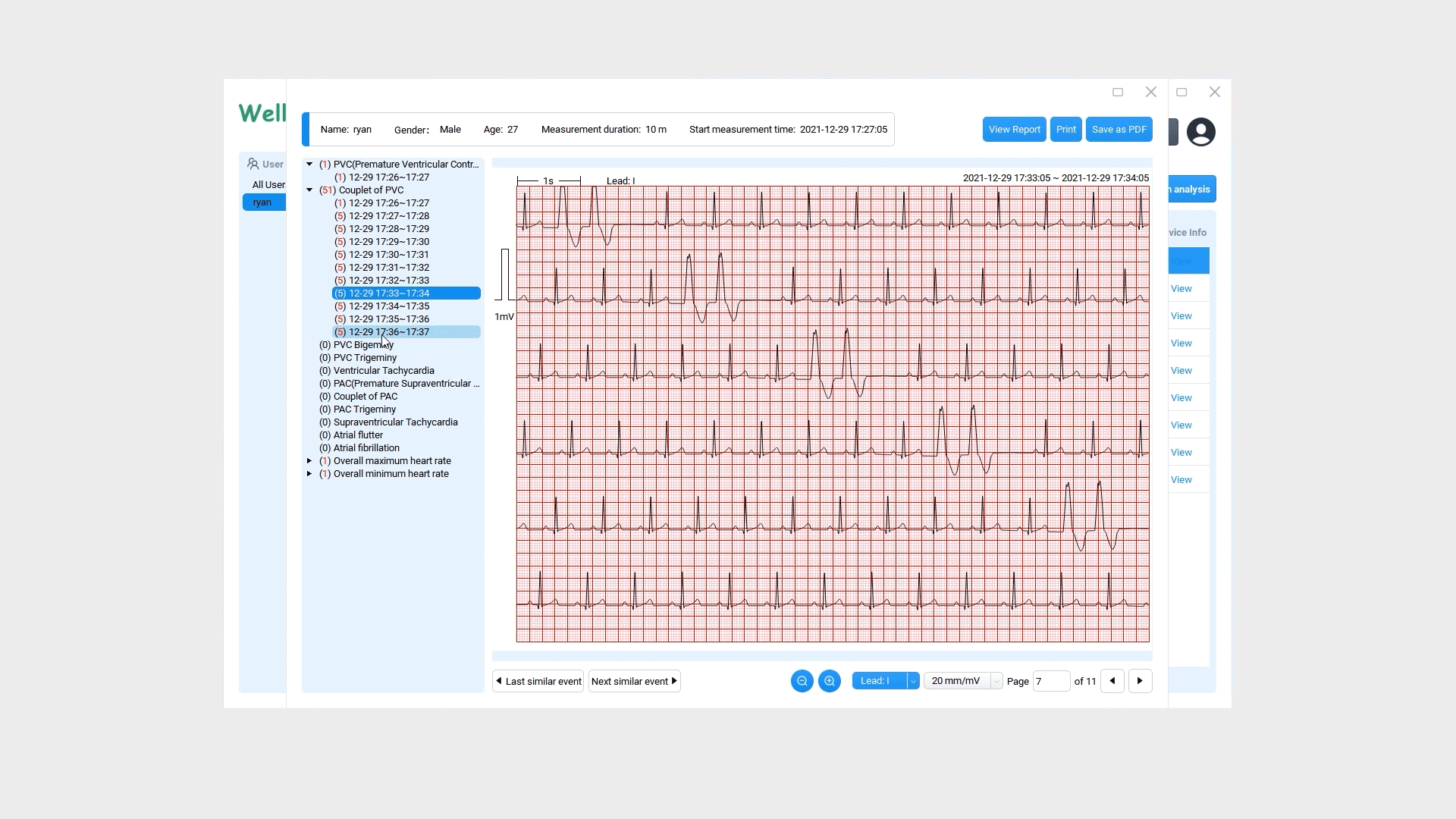 Livenpace TH12 12-Lead Holter ECG Monitor – 24-Hour Continuous Recording, AI Analysis Via PC Software, Portable Home Use