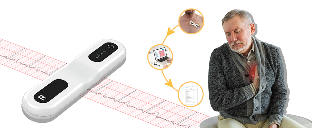 Checkme ER1-LW Langzeit-EKG-Gerät – 24h Aufzeich Produktbild-Vorschau 2