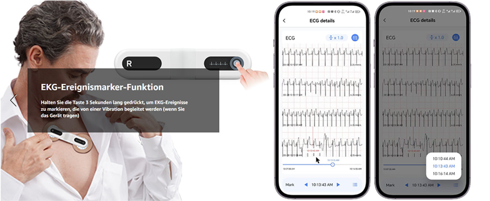 CheckMe Armfit Plus Blutdruckmessgerät Oberarm Bluetooth mit EKG CheckMe Armfit Plus Blutdruckmessgerät Oberarm Bluetooth mit EKG