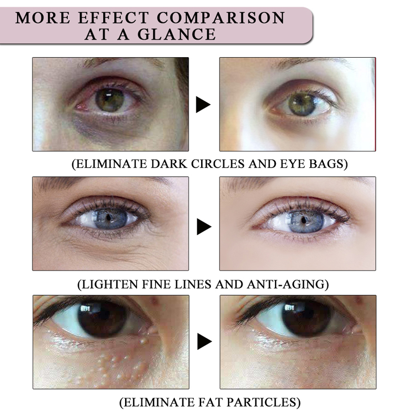 herbal probiotic eye cream