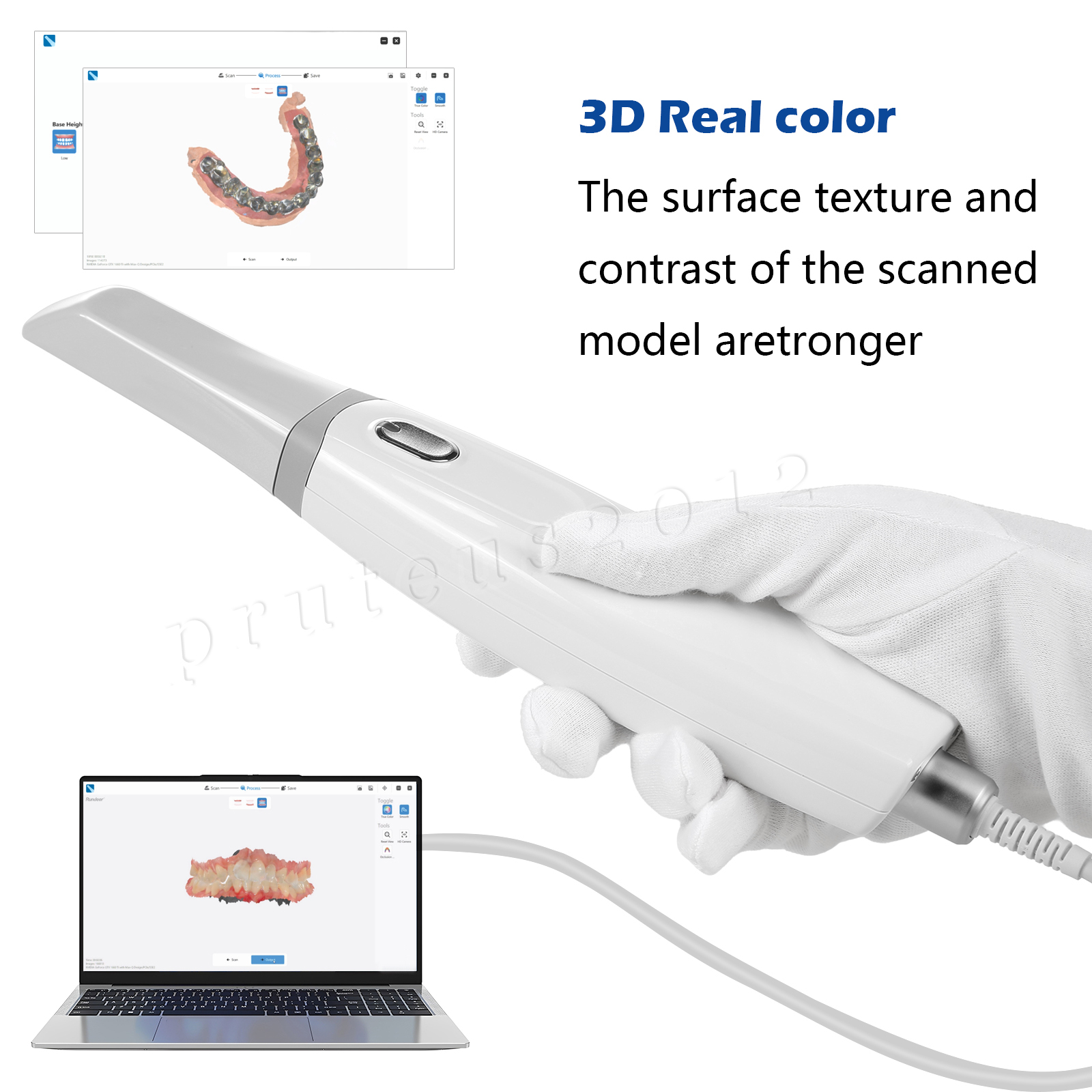 Dental Intra-oral Scanner 3D Real-time Display w/ AI Scanning Software + Tips