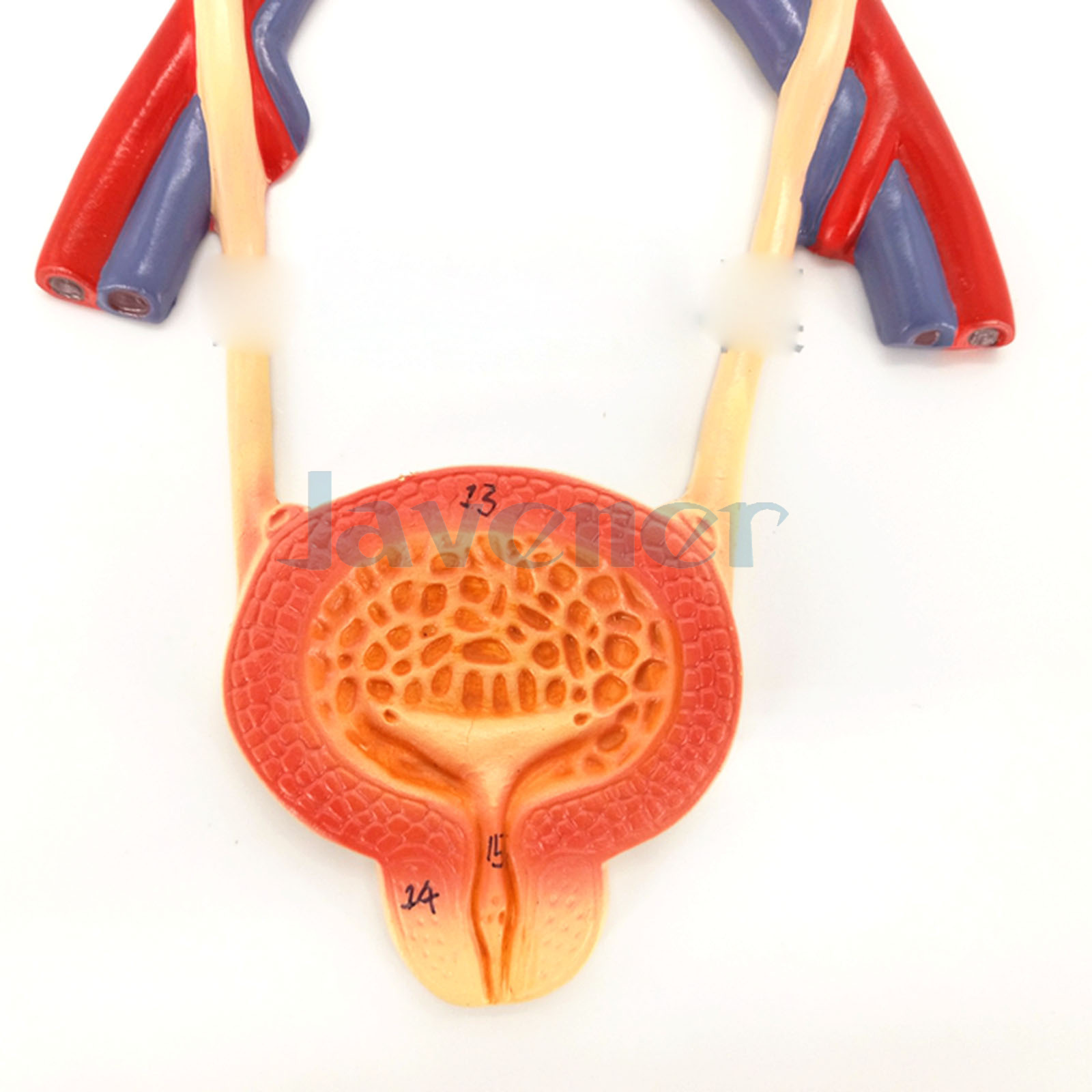 Anatomy Teaching Model Medical Bladder Liver Kidney Wall Plaque Urinary